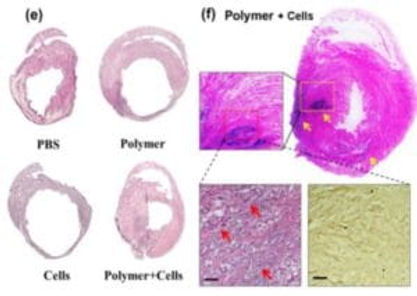 The effects of hydrogel when iPSC-CMs are encapsulated inside