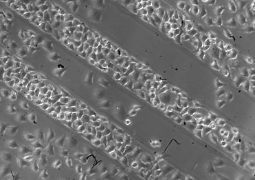 gel3_1hExpo_4C_001374-425x300