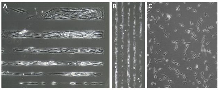 Phase contrast imaging of micropatterned muscle cells