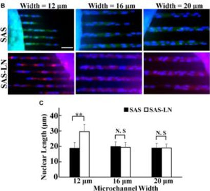 Nuclear deformation of cells head and neck squamous carcinoma