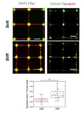 Epifluorescent images of cortical neuronal networks
