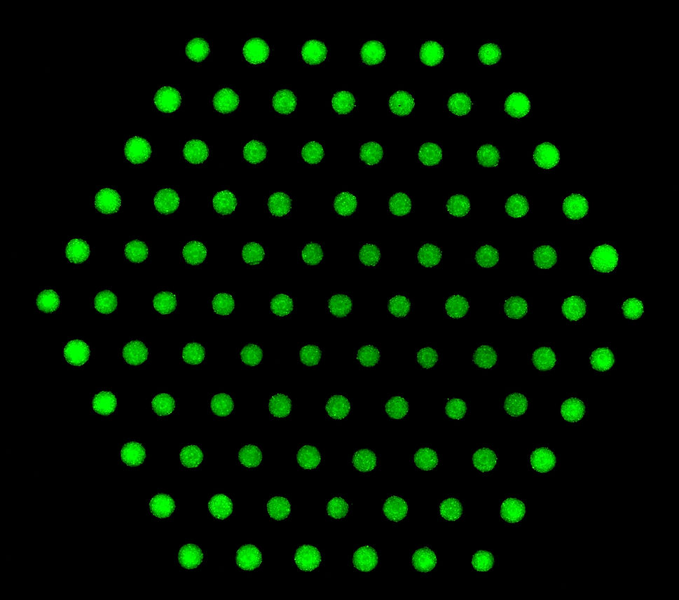 Spheroids of Mesenchymal stem cells labeled with GFP after 72 hours