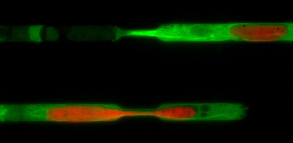 Cell migrating under constriction in microchannels