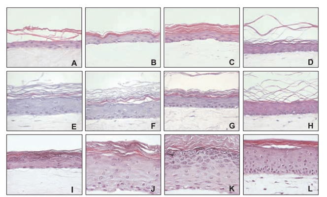 Figure 8. Reconstructed epidermis established on collagen matrices with increasing amounts of fibroblasts (A-H)