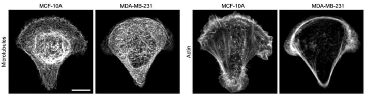 Microtubules in cancer cell MDA-MB-231