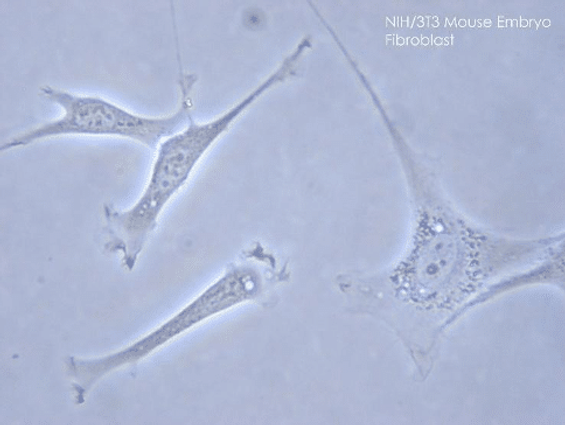Figure 1. Phase contrast microscopy image of fibroblasts from a mouse embryo. Encyclopaedia britannica