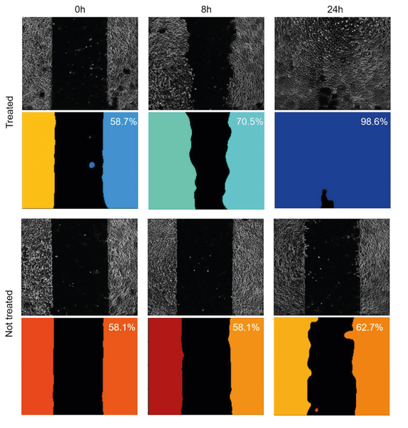 Setting up the wound healing assay using a 4DCELL dynamic micropatterned coverslip