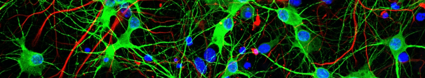 Neuronal network