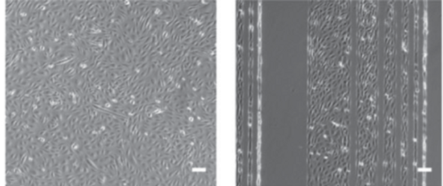 Comparison of muscle cells on micropattern or control
