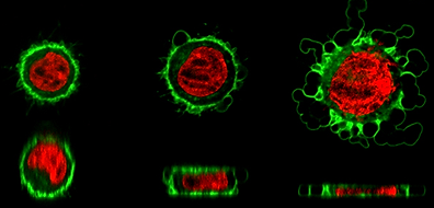 HeLa cells under confinement