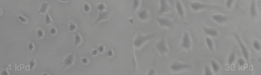 Cells on hydrogel
