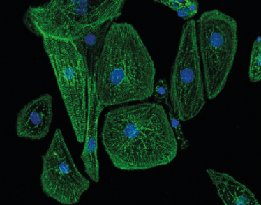 Non-micropatterned cardiomyocytes