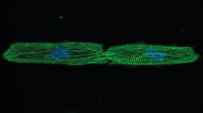 Micropatterned cardiomyocytes