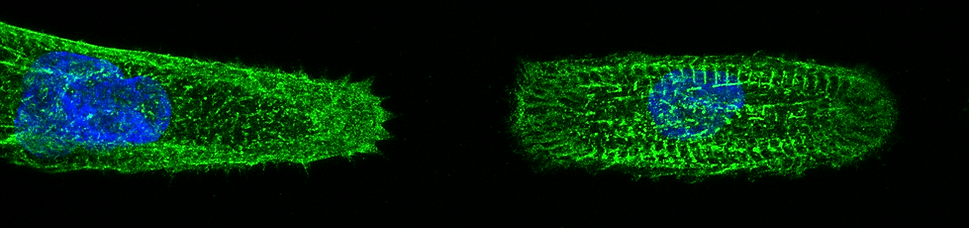 Cariomyocytes on line micropatterns