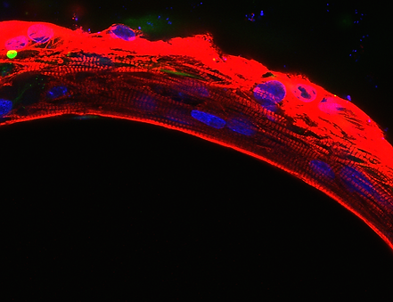 Sarcomeres observed in the SmartHeart